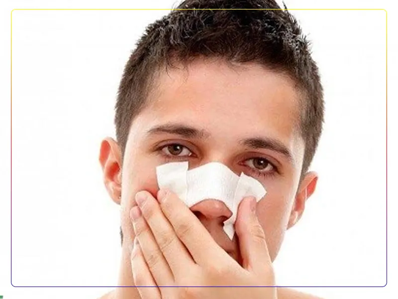 عمل بینی شکسته