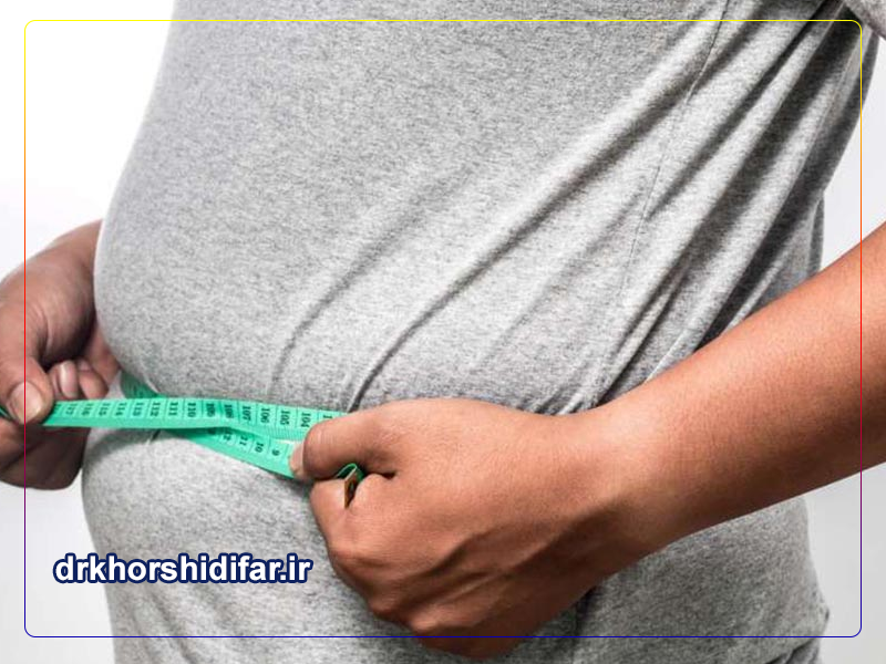 لیپو شکم و پهلو