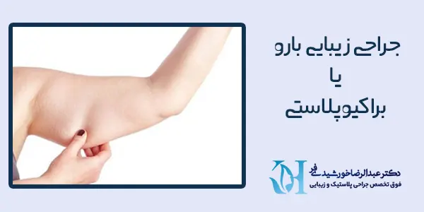جراحی براکیوپلاستی
