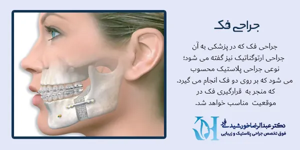 جراحی فک