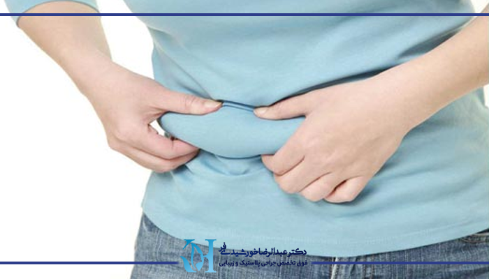 جراحی زیبایی شکم 