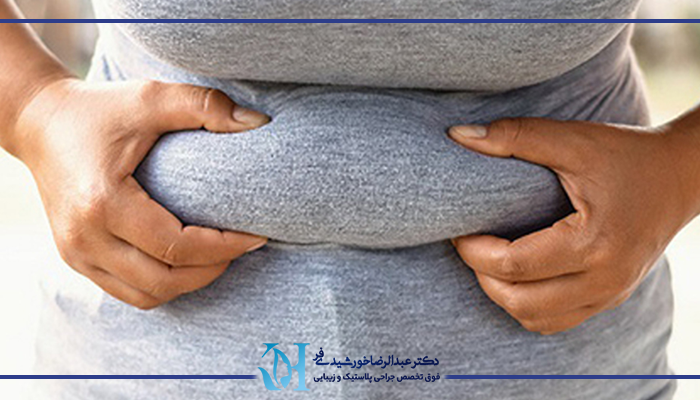 جراحی لیپوماتیک شکم و پهلو 