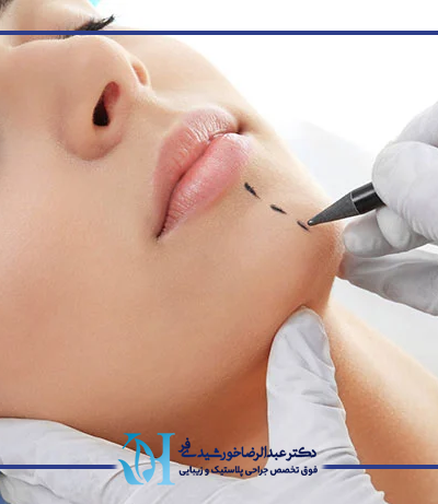 جراحی زیبایی چانه برای چه افرادی مناسب است؟ 