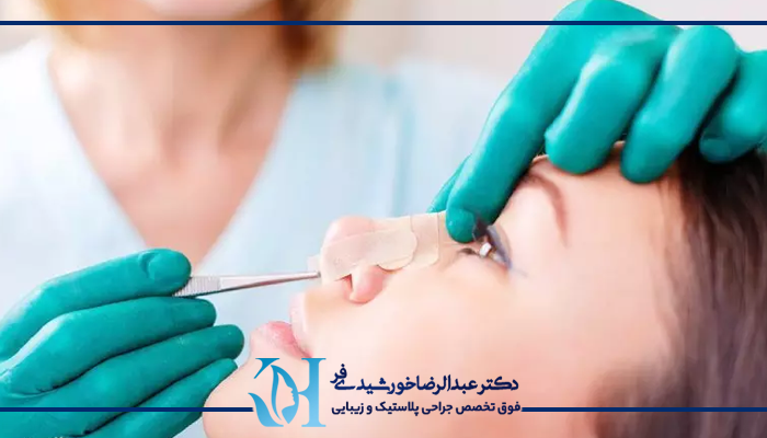 مراقبت های بعد از جراحی بینی 