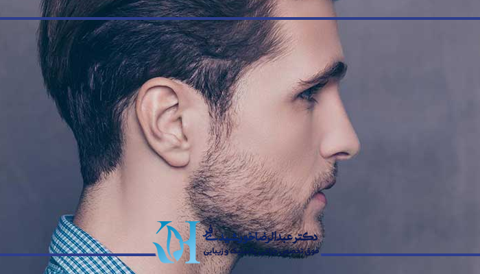 کاندیدای مناسب برای انجام جراحی بینی مردانه
